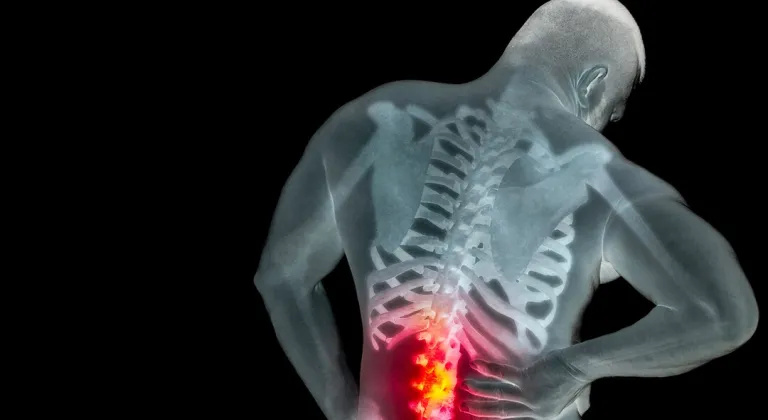 BEL FITIĞI NASIL GEÇER?